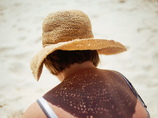 Stay Safe in the Florida Sun